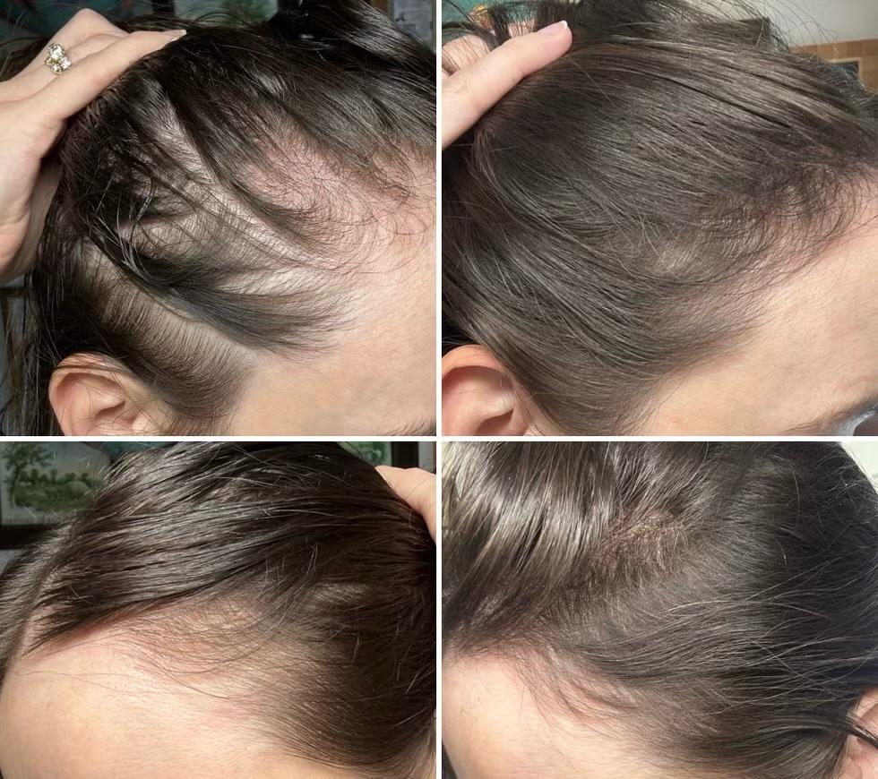 Hair result before and after thumbnail