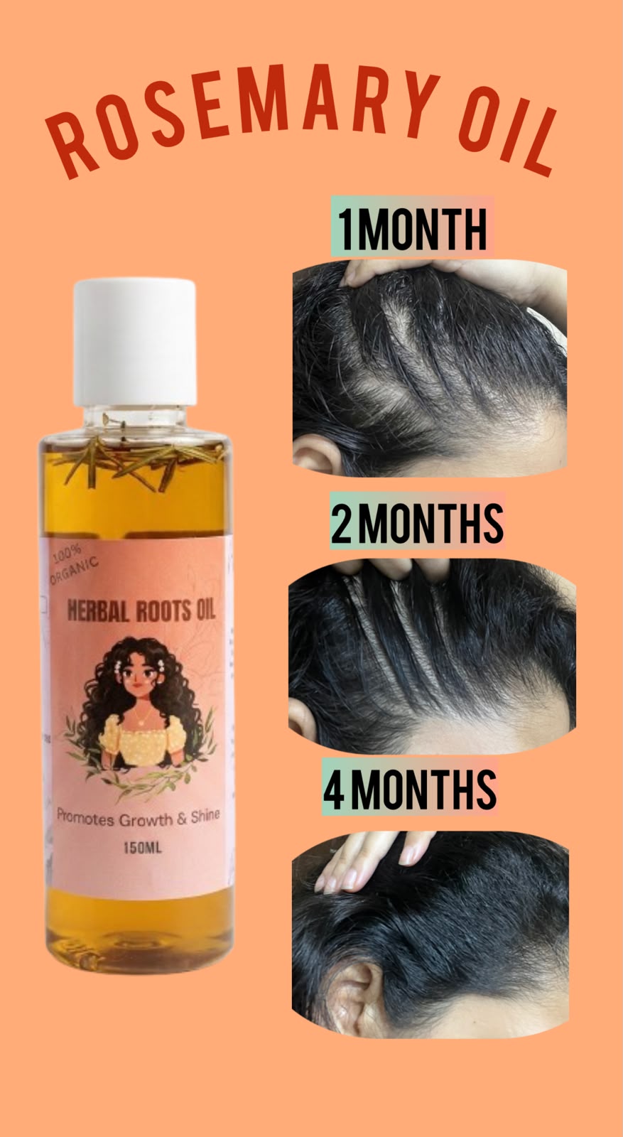 Hair growth progress at 1 month, 2 months, and 4 months using Herbal Roots Oil